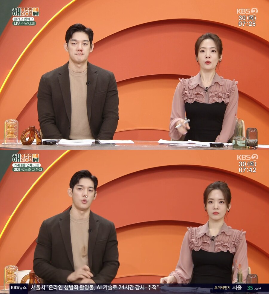 ▲ 박재민. 출처| KBS2 '해볼만한 아침 M&W' 방송 캡처