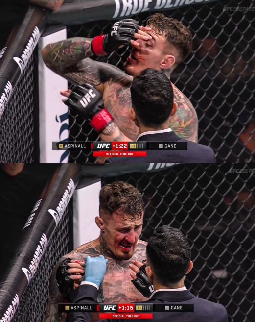 ▲ 시릴 간의 손가락에 눈을 찔린 뒤 통증을 호소하고 있는 톰 아스피날.