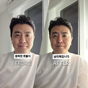 박지윤과 이혼 최동석, 인상 달라졌다…콧날 교정 비포&애프터 코끝 올라가