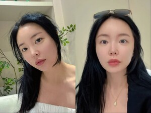 묘하게 달라졌다 …홍진영, 비주얼 변화에 솔직 고백 레이저 좀 쐈다